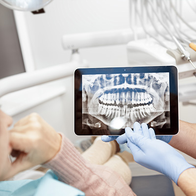 A dental professional using a digital tablet to view an X-ray of a patient s teeth.